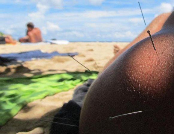 Balance Acupuncture • Massage